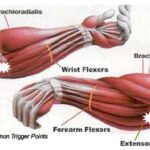 wrist flexor and extensor muscles of the forearm